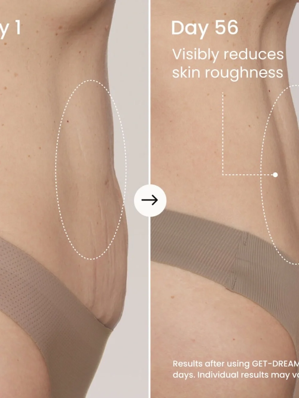 Maelys | Overnight Toning Body Whip
